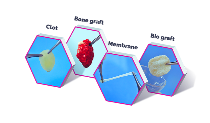 Biologics in Dentistry - A Holistic Approach