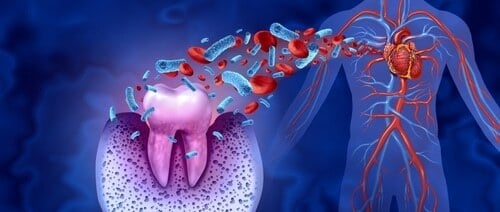 Full Mouth Reconstruction -The Gateway to Health Exploring the Mouth Body Connection