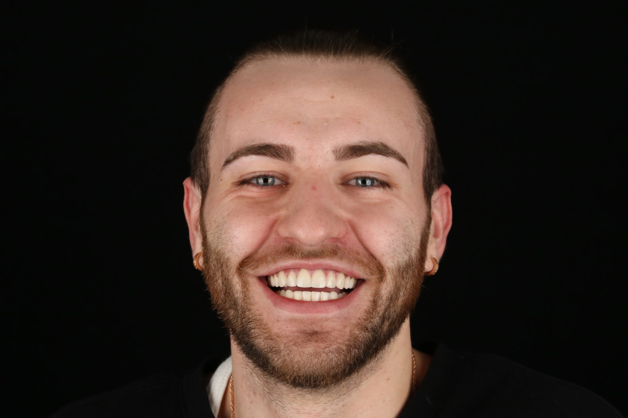 Logan Smile Post2 Logan Smile Post2