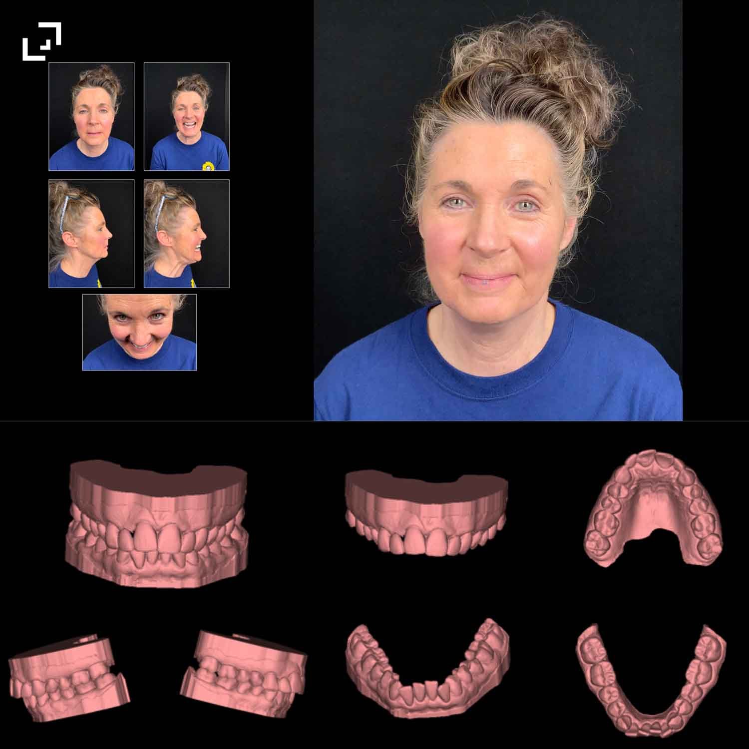 Step 1_ Comprehensive Digital Capture