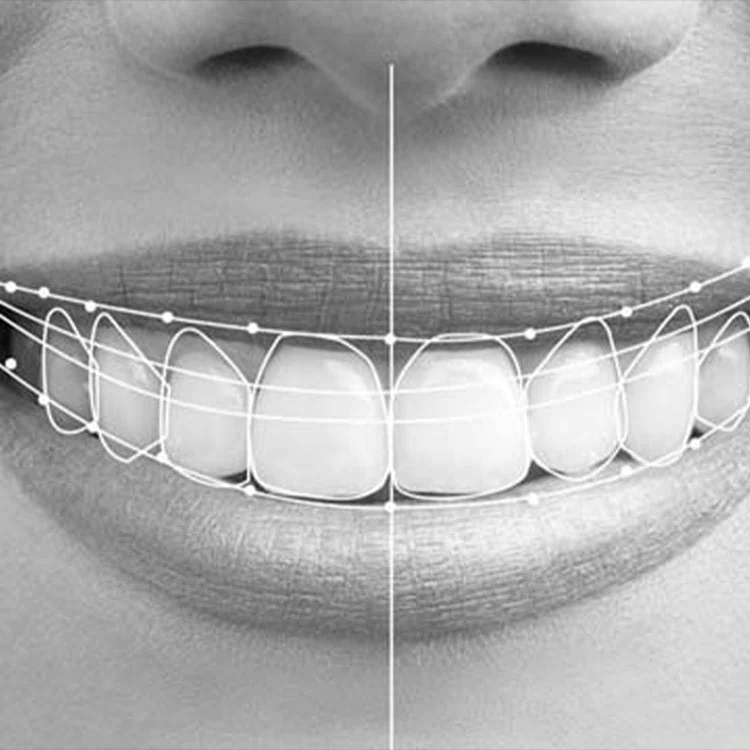 Step 3_ Your Smile Preview Appointment