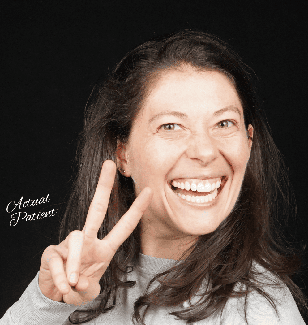 Smile Transformation Stories