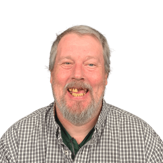 Brian Before Smile Makeover