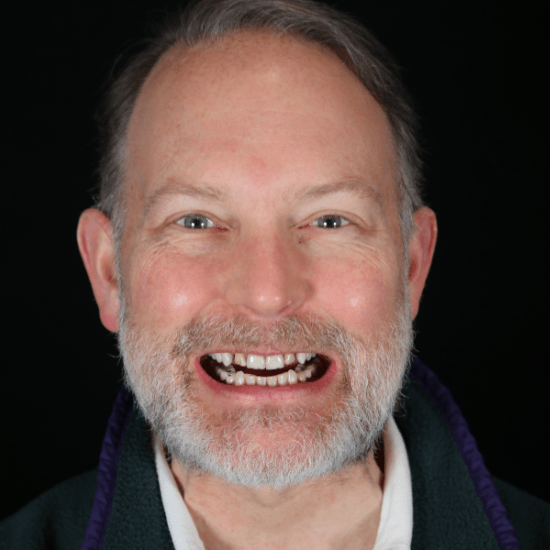 Jeffrey Before Smile Makeover 