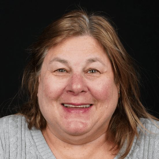Lisa Before her Smile Makeover