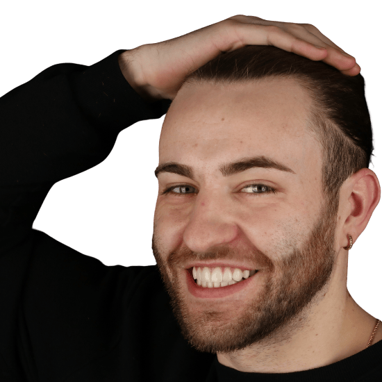 Logan Result Smile Makeover