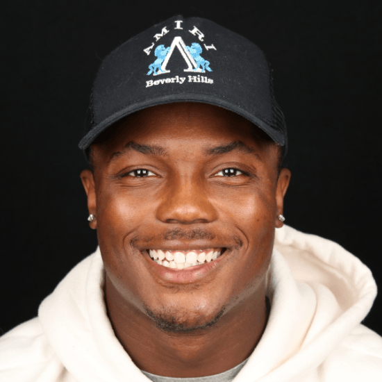 Terry Before Smile Makeover