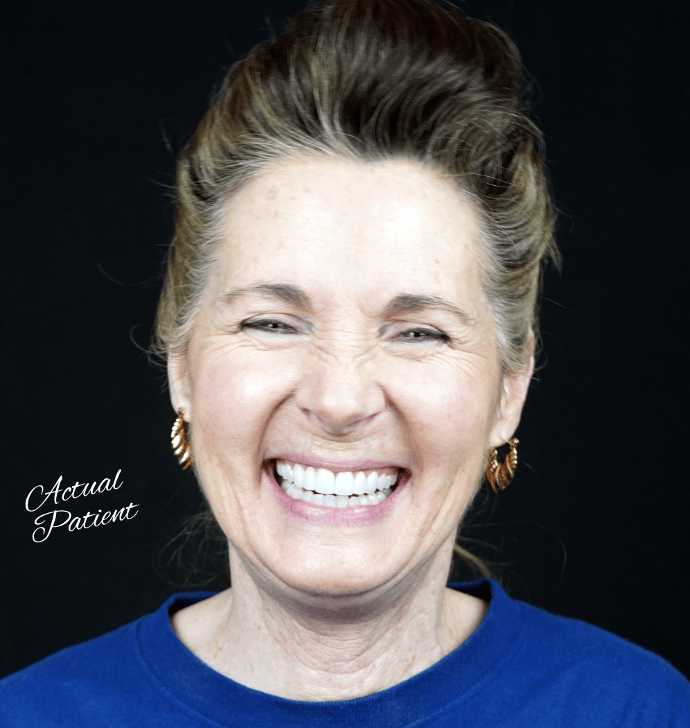 Dental Bridge Happy Patient