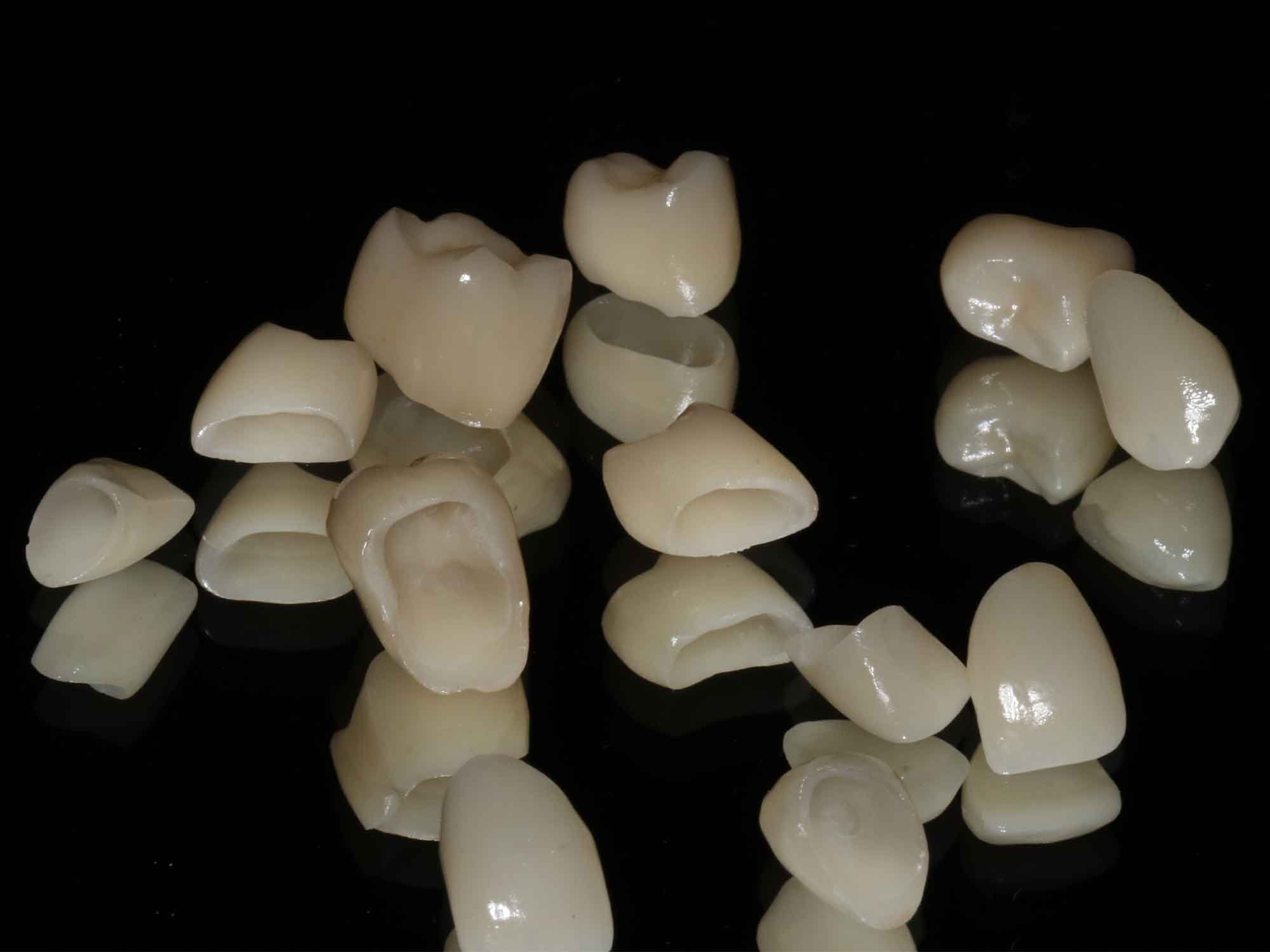 When Teeth Are Too Damaged for Fillings_ Why Crowns Become Necessary_Crowns