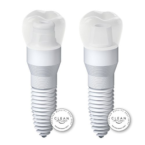 wellness centered implant dentistry-og