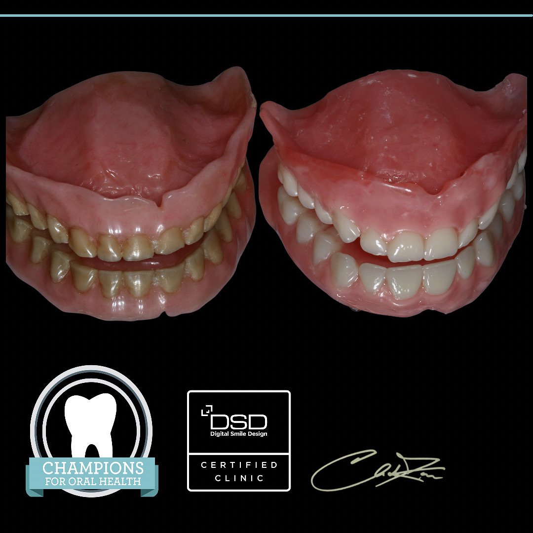 We see these patientds every week