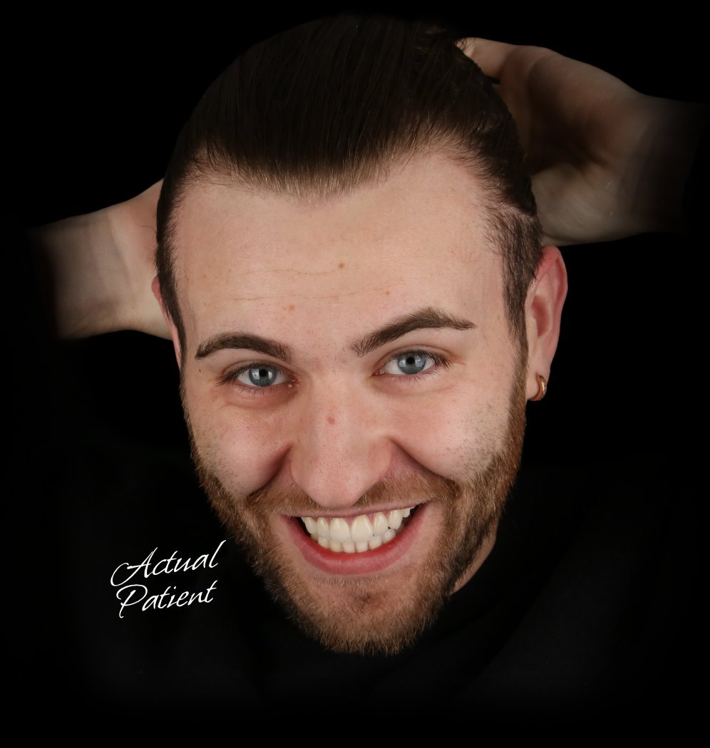 Teeth-Whitening-Hero