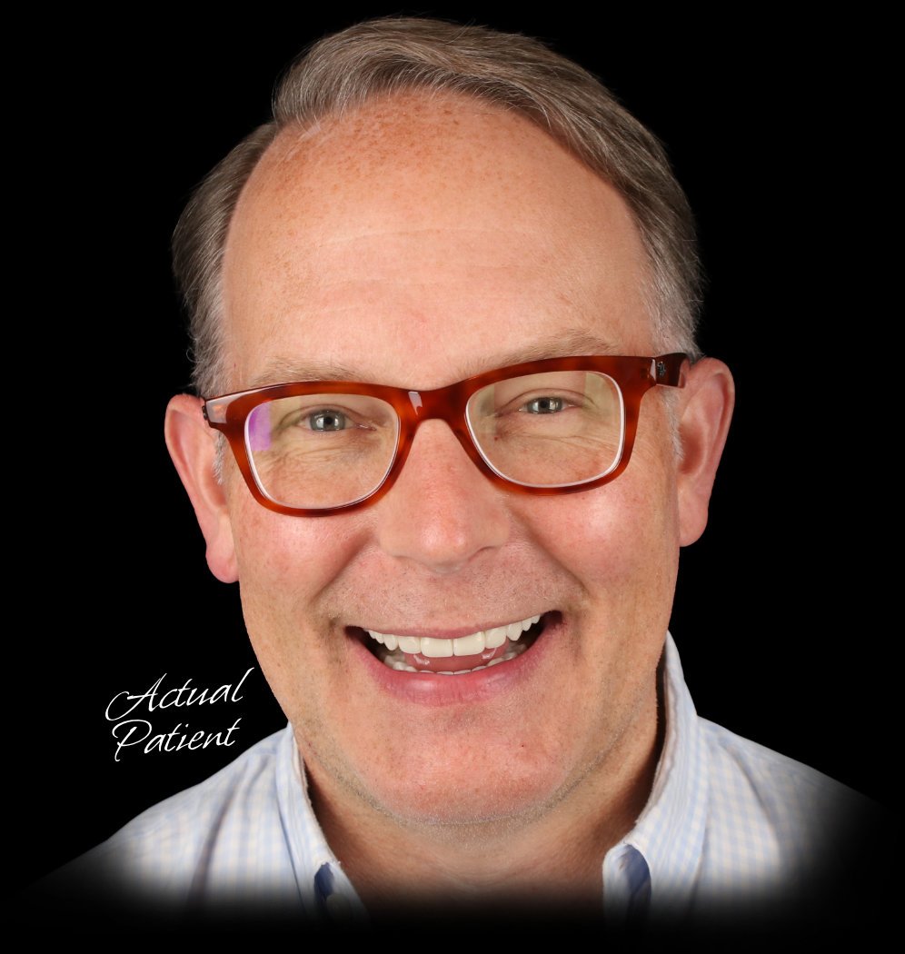 Test Drive Your Smile Actual Patient